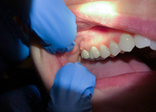 Best Emergency Treatment for Jaw Pain or Injury in Gantt, SC