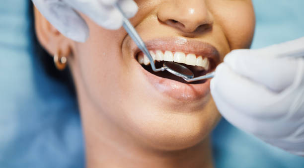 Best Emergency Root Canal Therapy in Gantt, SC